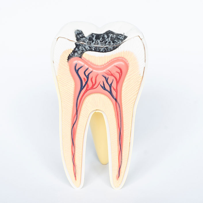 Cavity Detection System - Dental Technology